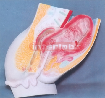 HUMAN MATERNITY POST PARTUM SHRINK OF UMBILICAL CORD MODEL